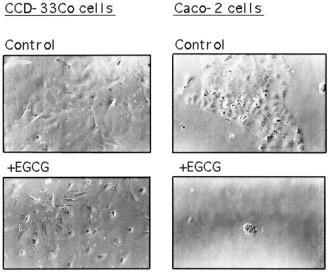 A Major Difference Between Cancer Cells And Normal Cells Is That