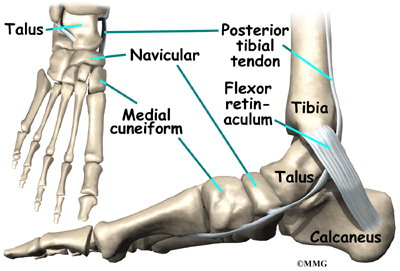 Accessory Navicular Syndrome Mri