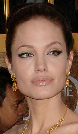 Angelina Jolie Lips Before After