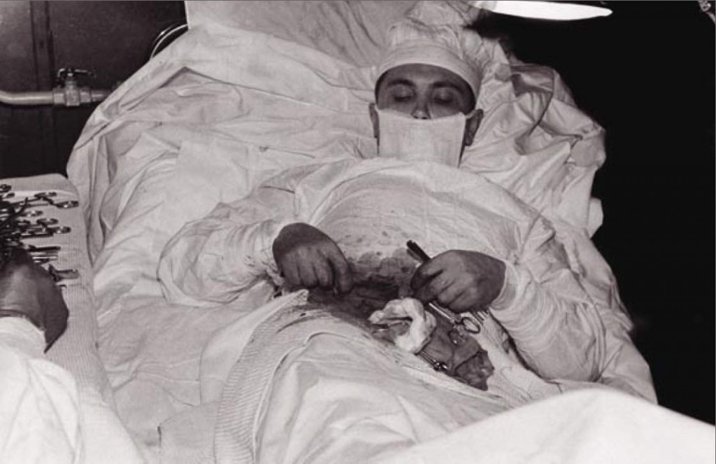 Appendix Operation