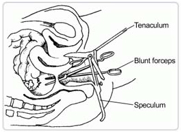 Appendix Operation Cost In India