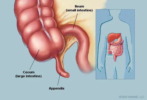 Appendix Pain Area