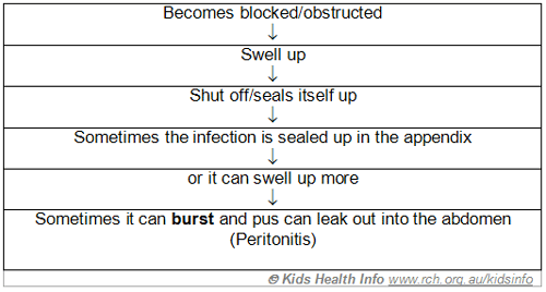 Appendix Pain Symptoms In Children