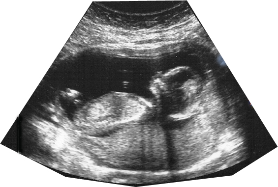 Applications Of Ultrasound In Daily Life