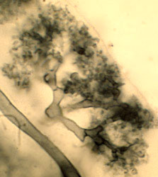 Arbuscular Mycorrhiza