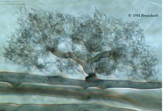 Arbuscular Mycorrhizal Symbiosis