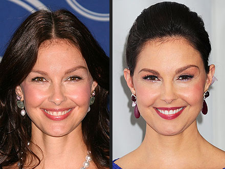 Ashley Judd Missing Plastic Surgery