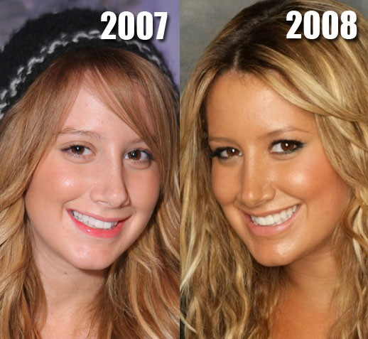 Ashley Tisdale Nose Job