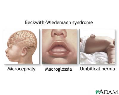 Autosomal Dominant Disorders Mnemonic