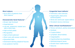 Autosomal Dominant Traits Quizlet