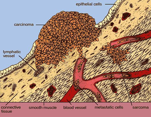 Cancer Cells Pictures