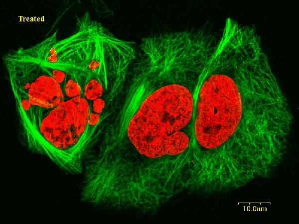 Cancer Cells Pictures