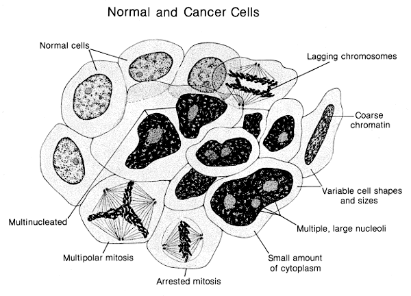 Cancer Cells Vs Normal Cells Pictures