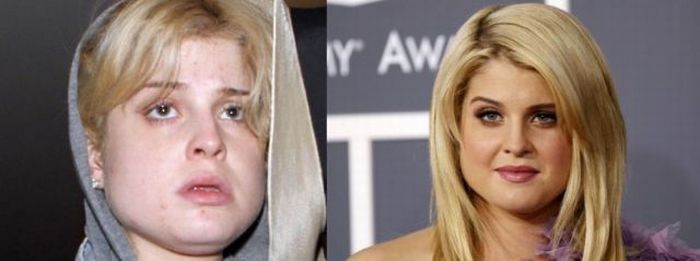 Celebs Before And After