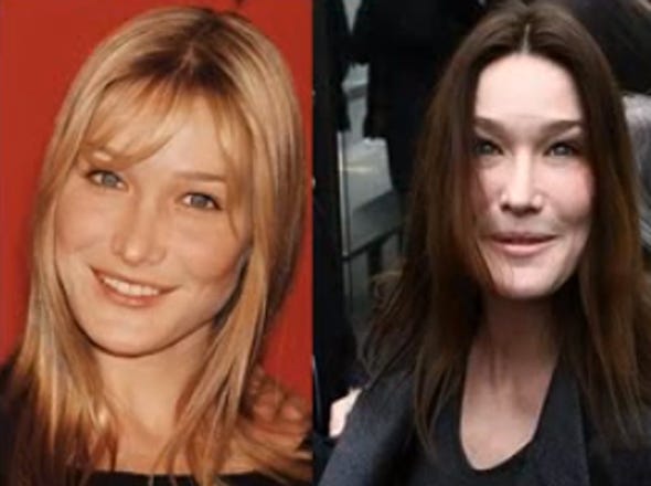 Celebs Before And After Drugs