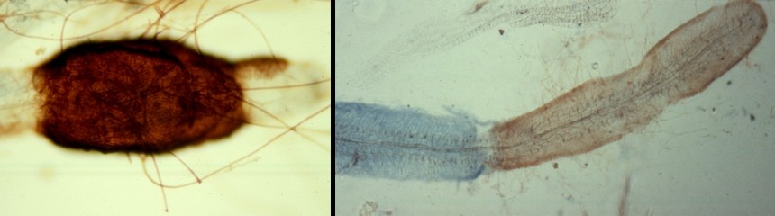 Ectomycorrhizal And Arbuscular Mycorrhizal