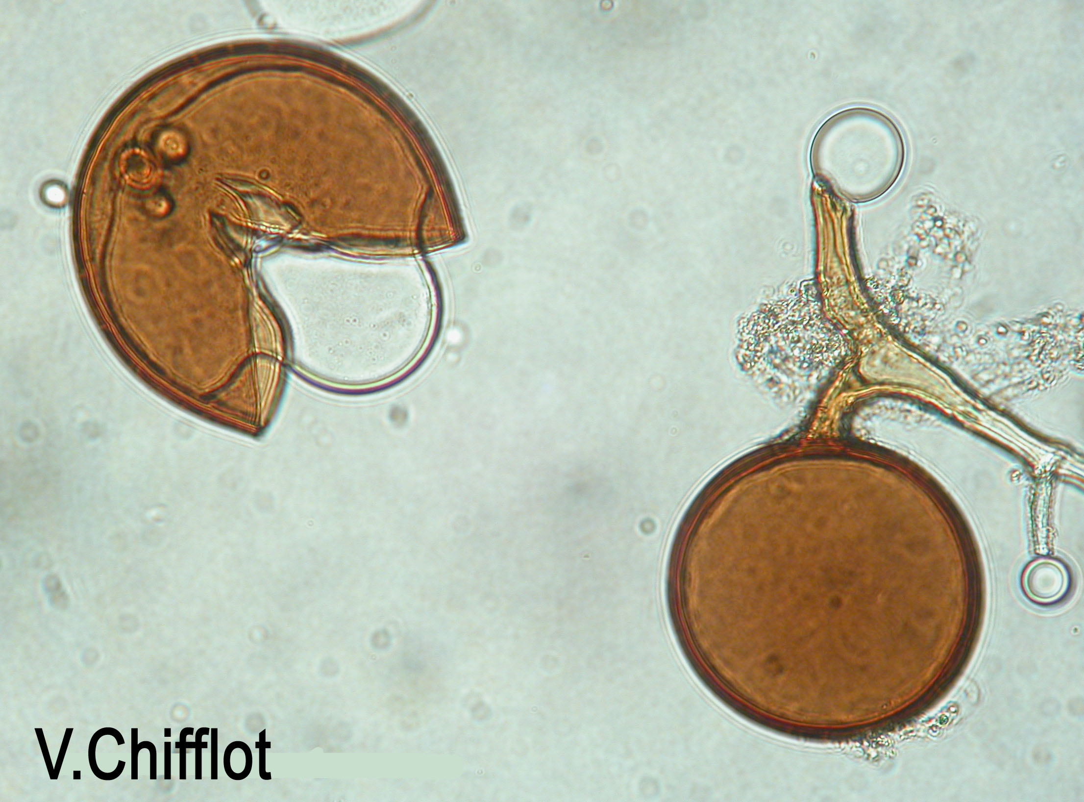 Ectomycorrhizal And Arbuscular Mycorrhizal Fungi