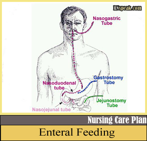 Enteral Feeding Tubes