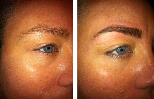 Hd Brows Before And After Reviews