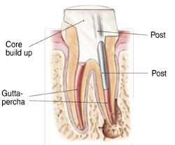 Health Care Card Dental Newcastle