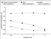 Language Development In Children After Receiving Bilateral Cochlear Implants Between 5 And 18 Months