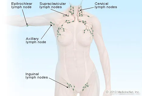 Locations Of Lymph Nodes In Women