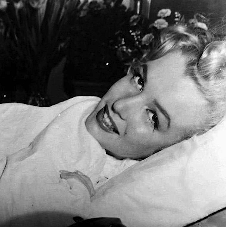 Marilyn Monroe Appendix Scar