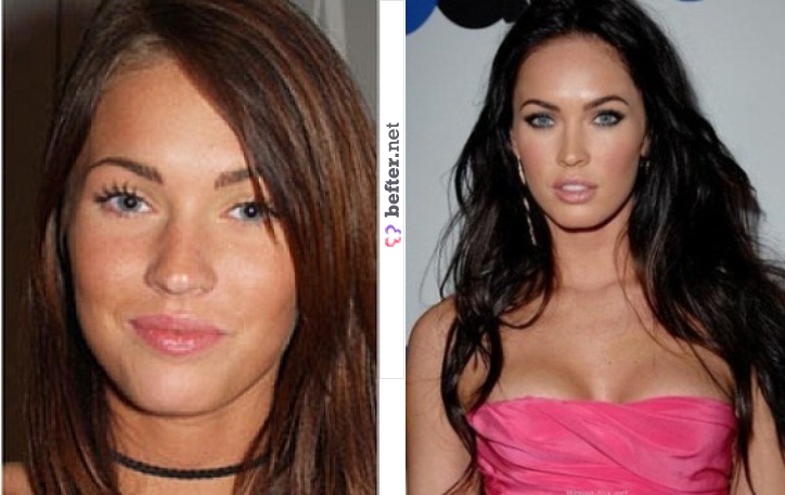 Megan Fox Before And After Plastic Surgery 2012