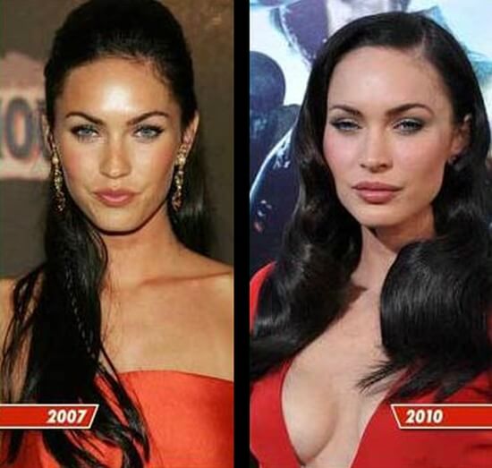 Megan Fox Before And After Plastic Surgery