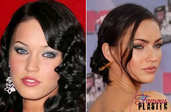 Megan Fox Before And After Surgery Pics