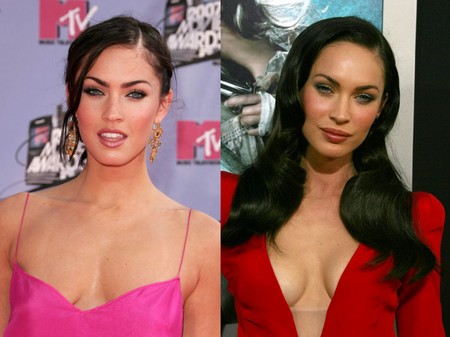 Megan Fox Before And After Surgery Pics