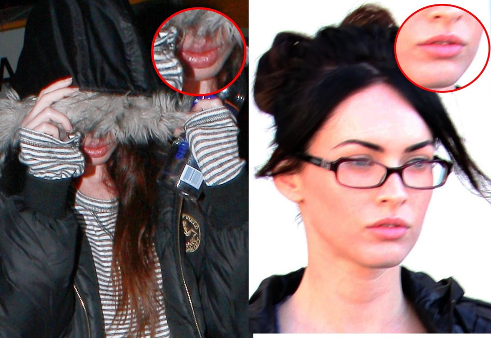 Megan Fox Before And After Surgery Pics