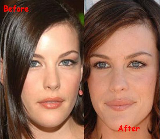 Megan Fox Before And After Surgery Pics