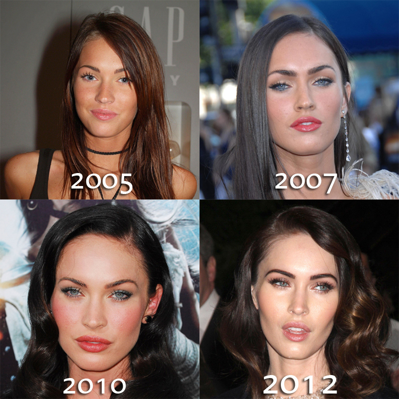 Megan Fox Before And After Surgery Pictures