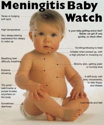 Meningitis In Children Guideline