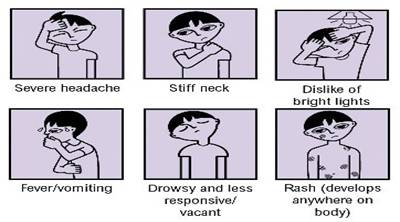 Meningitis Symptoms Rash Pictures