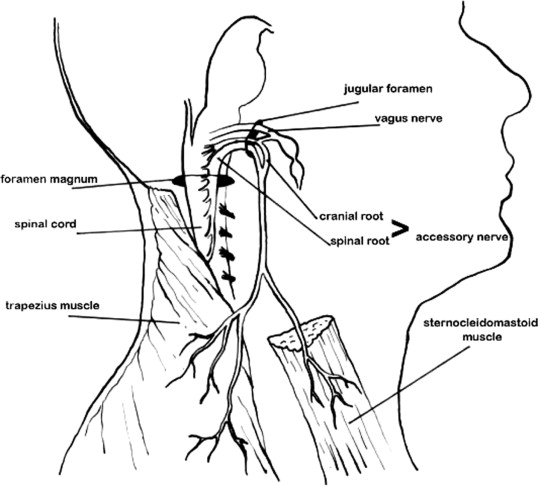 Spinal Accessory Nerve Injury Symptoms