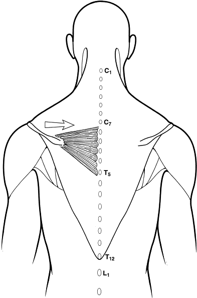 Spinal Accessory Nerve Injury Symptoms