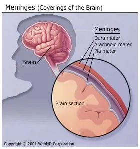 Spinal Meningitis Symptoms In Adults