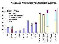 Ventricular Ectopy Icd 9