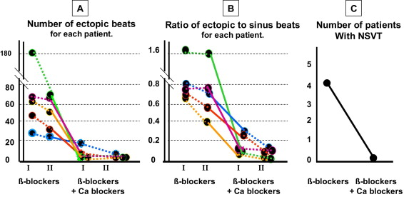 Ventricular Ectopy Icd 9