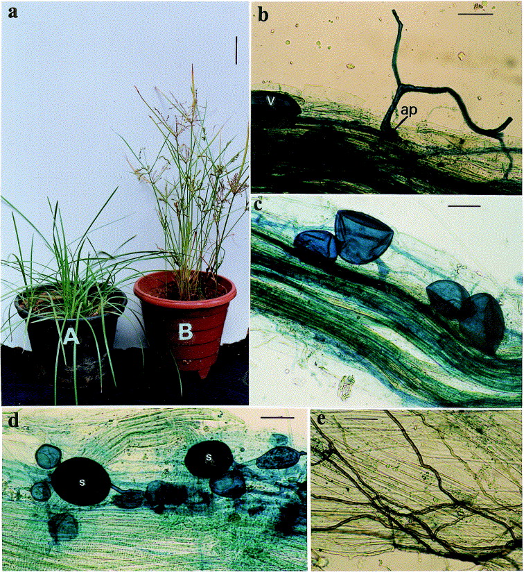 Vesicular Arbuscular Mycorrhiza Vam