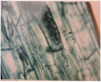 Vesicular Arbuscular Mycorrhiza Vam