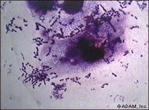 Whooping Cough Bacteria Pictures