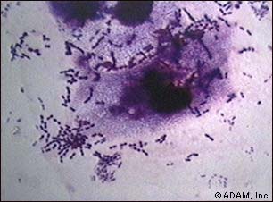 Whooping Cough Bacterial